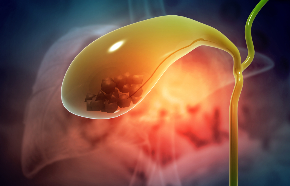 gall bladder stones related treatment and service by K. Kapil Nagaraj, best gastroenterologists in Mumbai